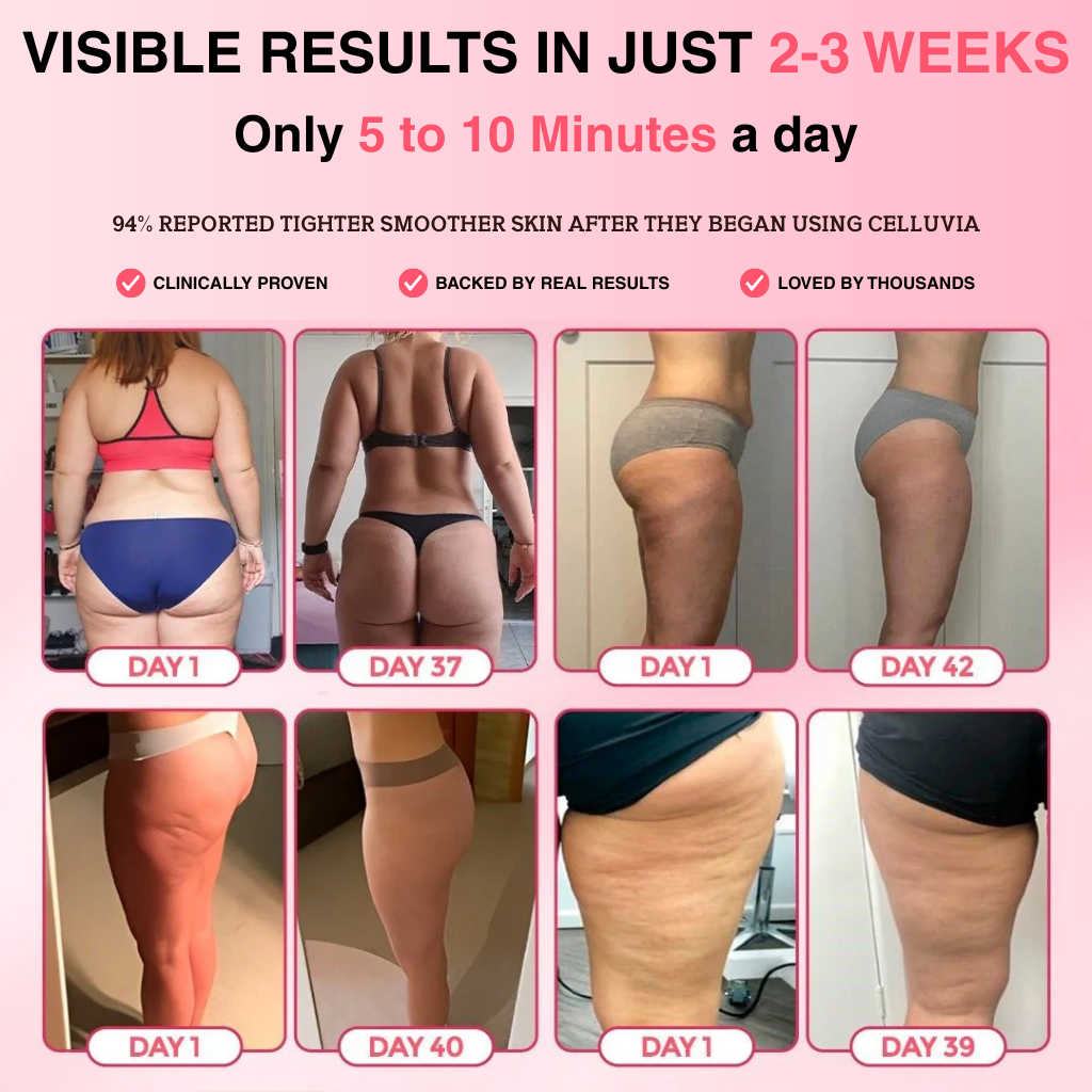 Celluvia™ Cellulite Relief Kit