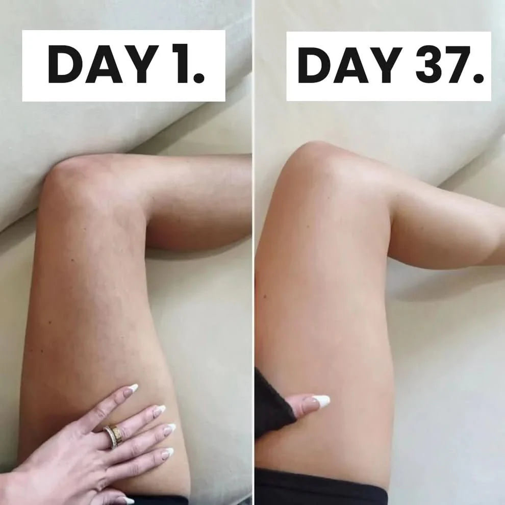 Celluvia™ Cellulite Relief Kit
