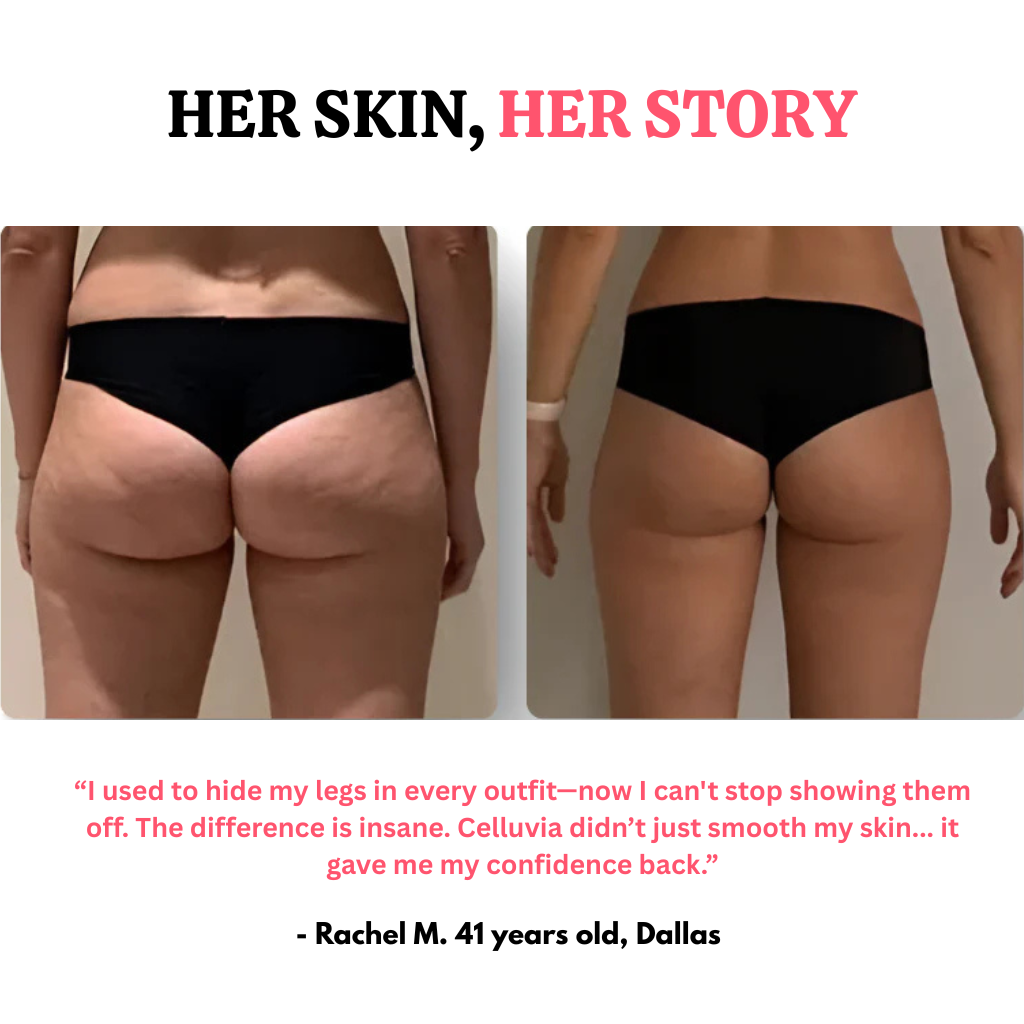 Celluvia™ Cellulite Relief Kit